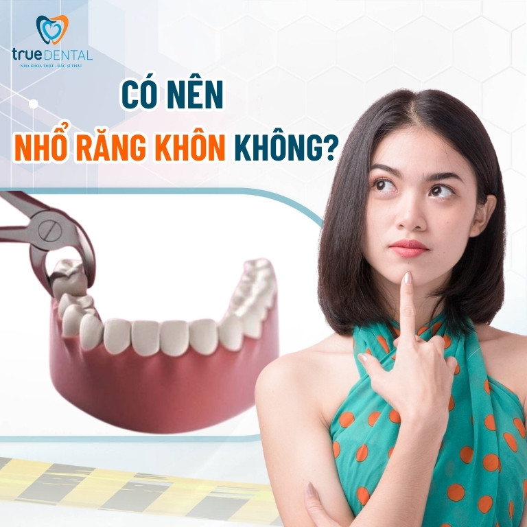 Nhổ răng khôn: Quy trình, có nên nhổ không và những lưu ý 2 Có nên nhổ răng khôn không?