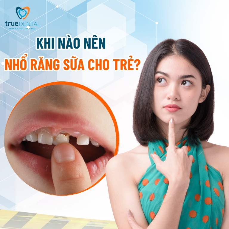 NHỔ RĂNG SỮA CHO TRẺ EM: LỢI ÍCH VÀ NHỮNG ĐIỀU CẦN LƯU Ý 3 Khi nào nên nhổ răng sữa cho trẻ?