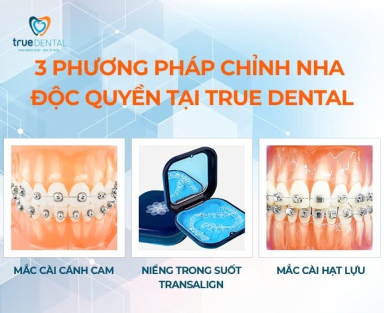 NIỀNG RĂNG CÓ BỊ HÔI MIỆNG KHÔNG? LÀM SAO ĐỂ ĐIỀU TRỊ? 3 Cách phòng ngừa và điều trị hôi miệng khi niềng răng