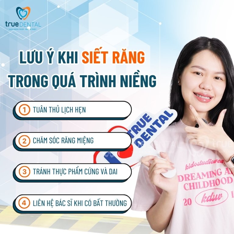 SIẾT RĂNG KHI NIỀNG LÀ GÌ? DIỄN RA NHƯ THẾ NÀO? CÓ ĐAU KHÔNG? 5 Lưu ý khi siết răng trong quá trình niềng