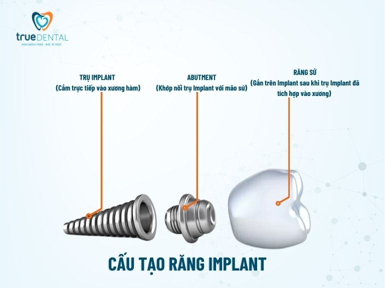 Trồng răng Implant là gì? Những điều cần biết, giá bao nhiêu 2 Cấu tạo răng Impant
