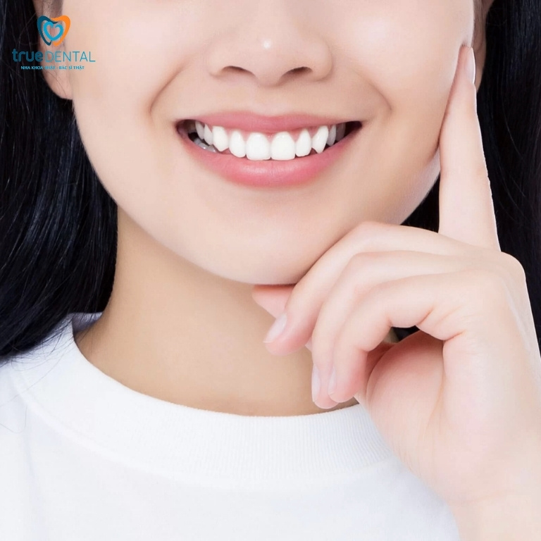 Bọc răng sứ mất bao lâu thì bình thường? 4 Bọc răng sứ thẩm mỹ bao lâu thì hồi phục hoàn toàn?