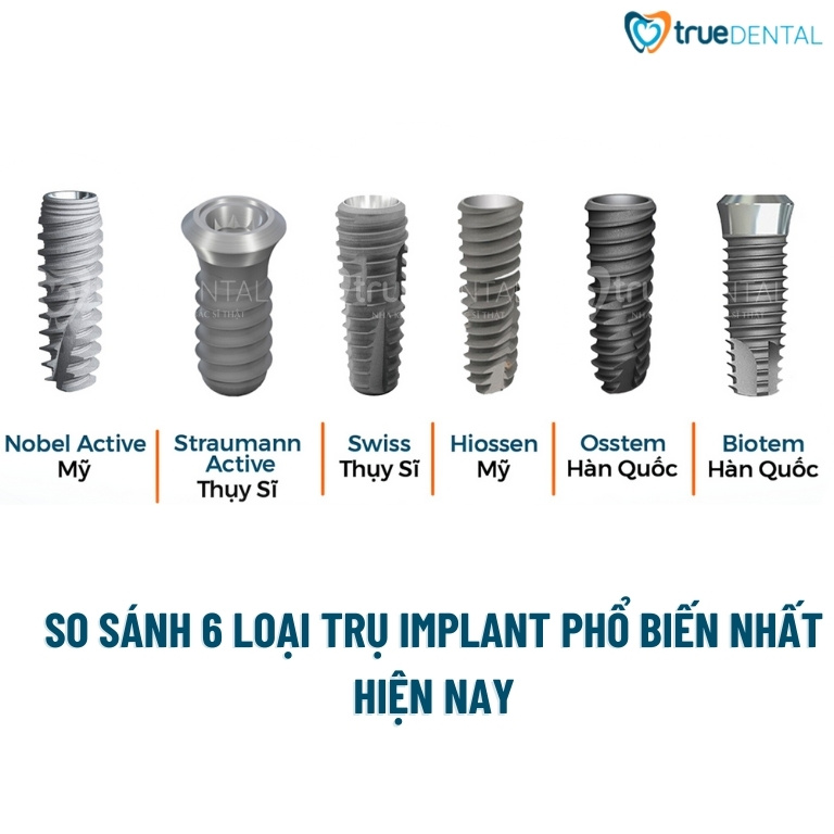 Implant nha khoa là gì? khi nào cần cấy ghép implant 7 6 loại trụ Implant nha khoa phổ biến nhất hiện nay
