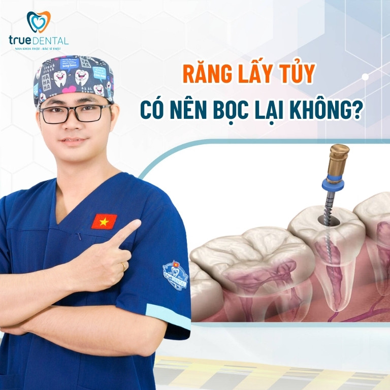 Răng lấy tủy có nên bọc răng sứ lại không? 2 Răng lấy tủy có nên bọc răng sứ lại không?
