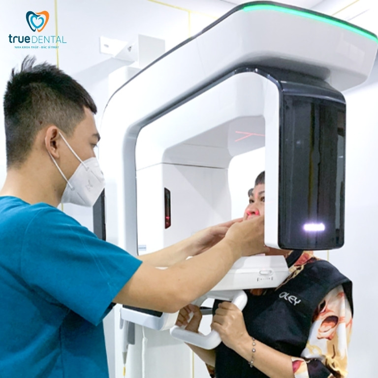 Viêm nha chu: Dấu hiệu, nguyên nhân và cách điều trị 9 Chụp X-Quang, CT ConeBeam chẩn đoán viên nha chu