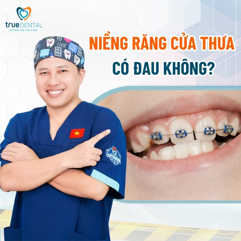 Chi phí niềng răng cửa thưa bao nhiêu tiền? Mất bao lâu? 3 Niềng răng cửa thưa có đau không?
