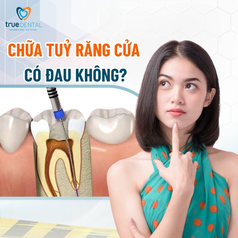 Chữa tủy răng cửa: Những điều cần biết 3 Chữa tuỷ răng cửa có đau không?