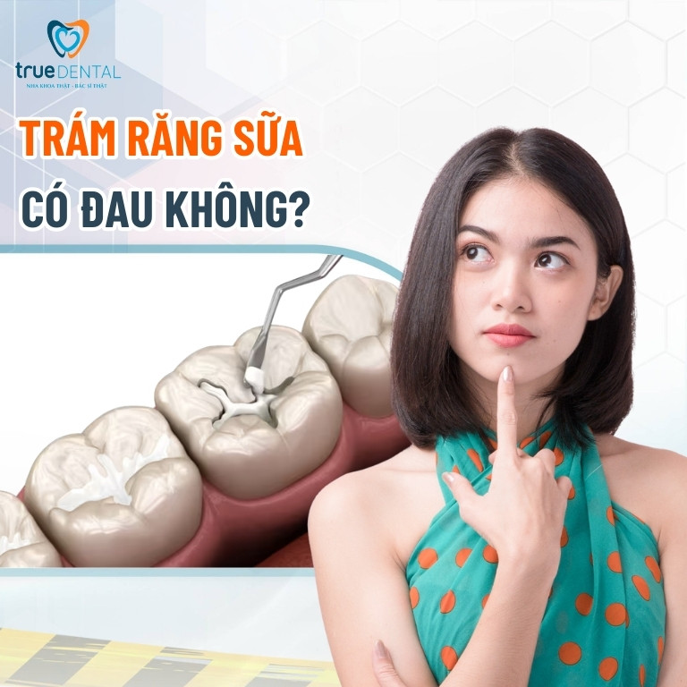 Có nên trám răng sâu cho trẻ em hay không? Trường hợp cần trám 8 Trám răng sữa có đau không?