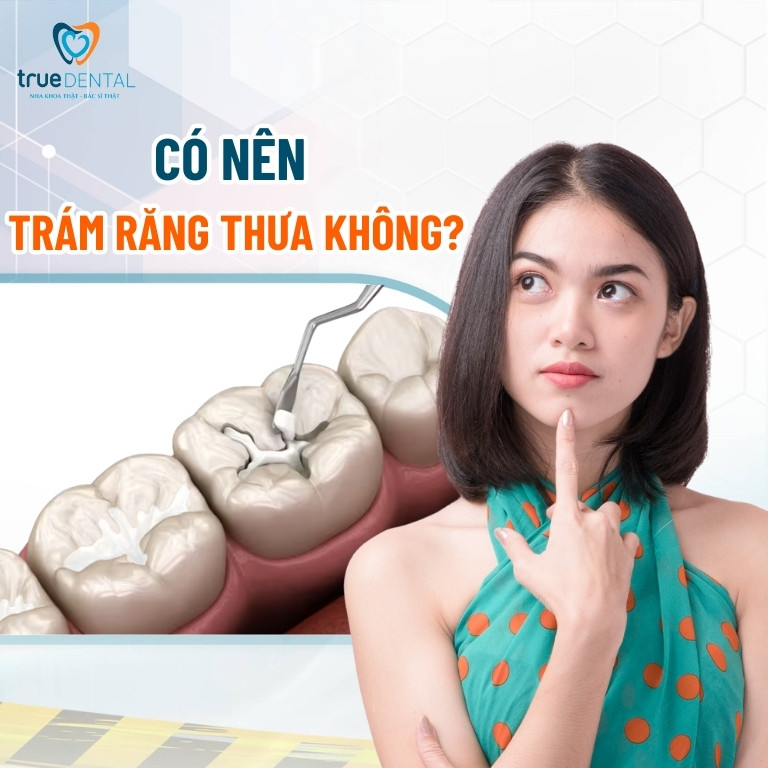 Có nên trám răng thưa không? Chi phí bao nhiêu tiền? 3 Có nên trám răng thưa không?