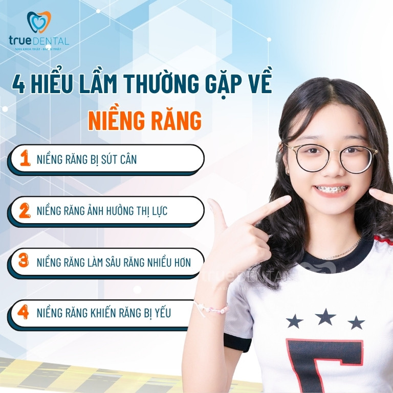 8 lợi ích của niềng răng và một số hiểu lầm thường gặp 3 Những hiểu lầm thường gặp về niềng răng