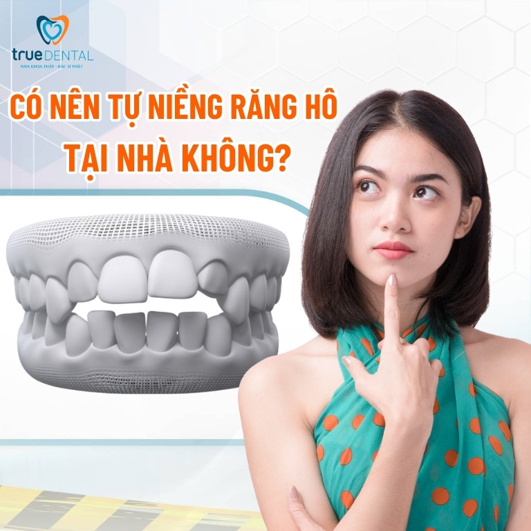 Cách làm răng hết hô tại nhà đơn giản mà hiệu quả 9 Có nên tự niềng răng hô tại nhà không?
