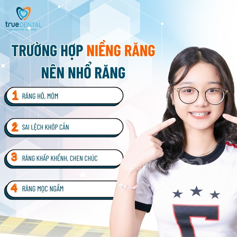 Niềng răng không nhổ răng có hiệu quả không? Trường hợp không nhổ răng khi niềng? 1 Trường hợp nên nhổ răng khi niềng