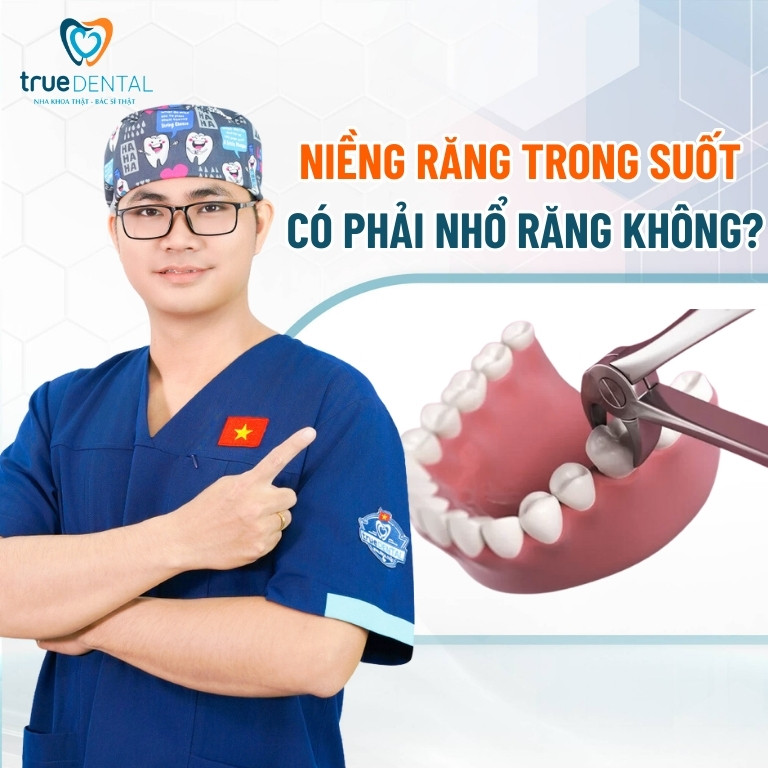 Niềng răng trong suốt có phải nhổ răng không? - Bác sĩ giải đáp 2 Niềng răng trong suốt có phải nhổ răng không?