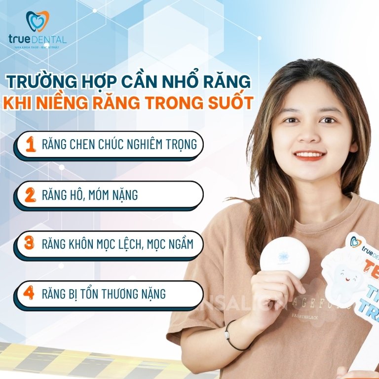 Niềng răng trong suốt có phải nhổ răng không? - Bác sĩ giải đáp 3 Khi nào nên nhổ răng khi niềng răng trong suốt?