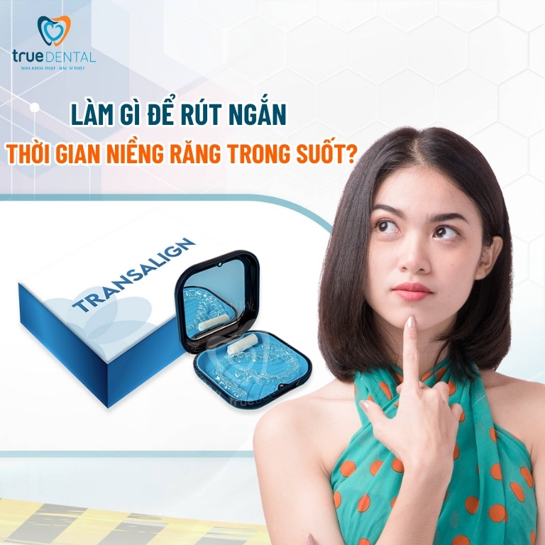 Niềng răng trong suốt mất bao lâu để đạt hiệu quả? 4 Làm gì để rút ngắn thời gian niềng răng trong suốt?
