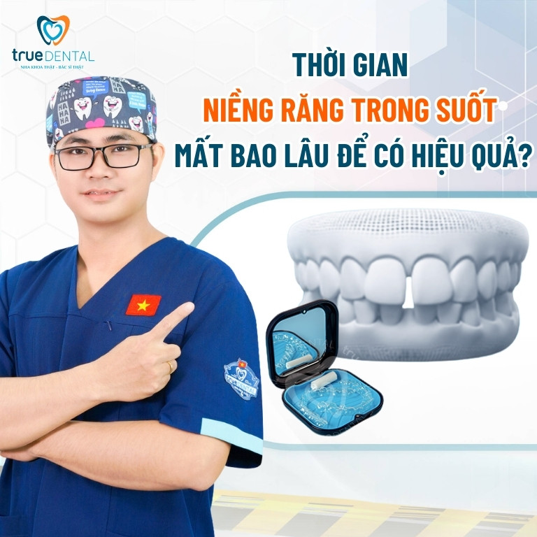 Niềng răng trong suốt mất bao lâu để đạt hiệu quả? 2 Thời gian niềng răng trong suốt mất bao lâu để có hiệu quả?
