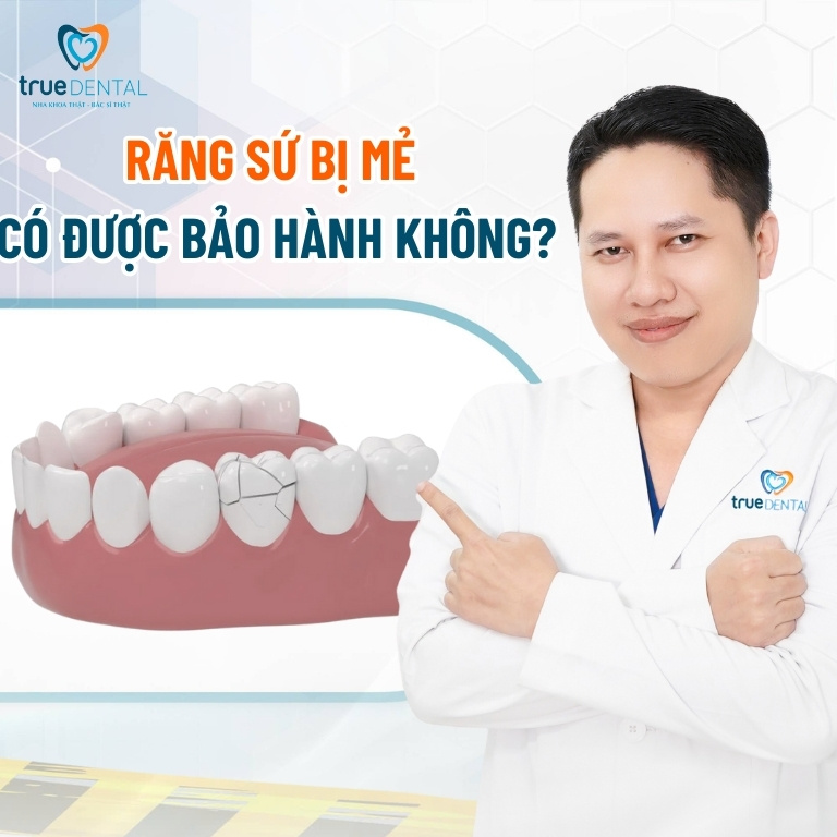 Răng sứ bị mẻ có trám được không? Làm gì khi răng sứ vỡ, mẻ? 4 Răng sứ bị mẻ có được bảo hành không?