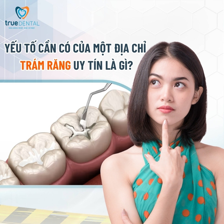 Trám răng ở đâu tốt tại TPHCM? Review 8 địa chỉ uy tín 1 8 Yếu tố cần có của một địa chỉ trám răng uy tín tại TPHCM