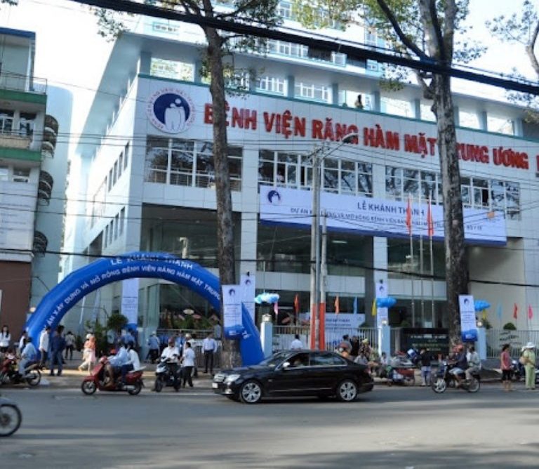 Trám răng ở đâu tốt tại TPHCM? Review 8 địa chỉ uy tín 6 Review trám răng ở bệnh viện Răng Hàm Mặt Trung ương