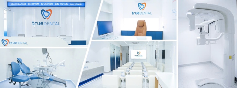Trám răng ở đâu tốt tại TPHCM? Review 8 địa chỉ uy tín 4 Trám răng ở đâu tốt tại TPHCM? Nha khoa THẬT