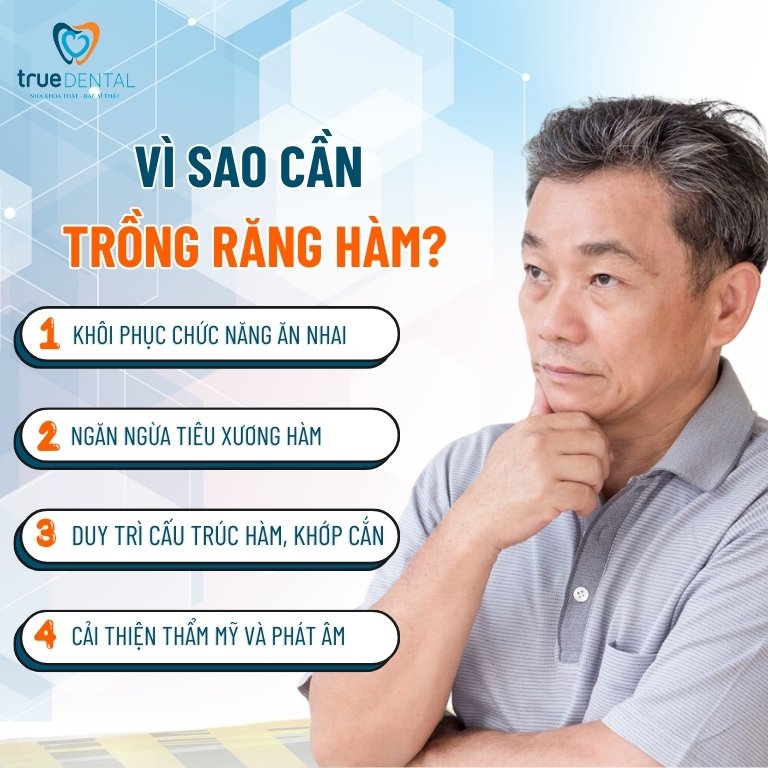 Trồng răng hàm giá bao nhiêu tiền? Phương pháp nào hiệu quả 1 Vì sao cần trồng răng hàm?