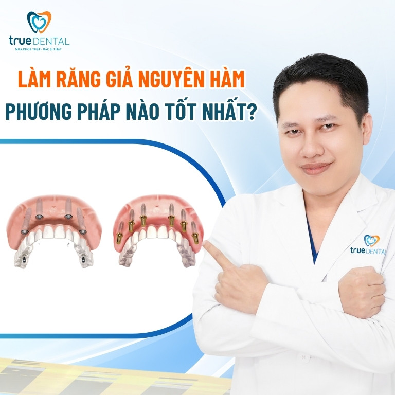 Chi phí trồng răng giả giá bao nhiêu tiền 1 cái? Bảng giá 2025 6 Làm răng giả nguyên hàm phương pháp nào tốt nhất?