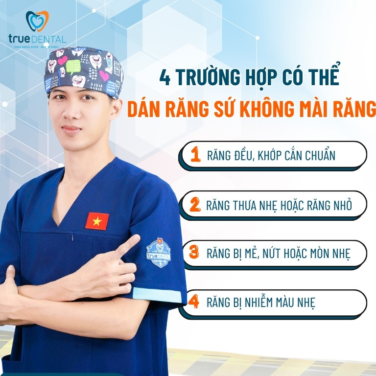 Kỹ thuật dán sứ veneer không mài răng là gì? 4 Những trường hợp áp dụng được phương pháp dán răng sứ không mài răng