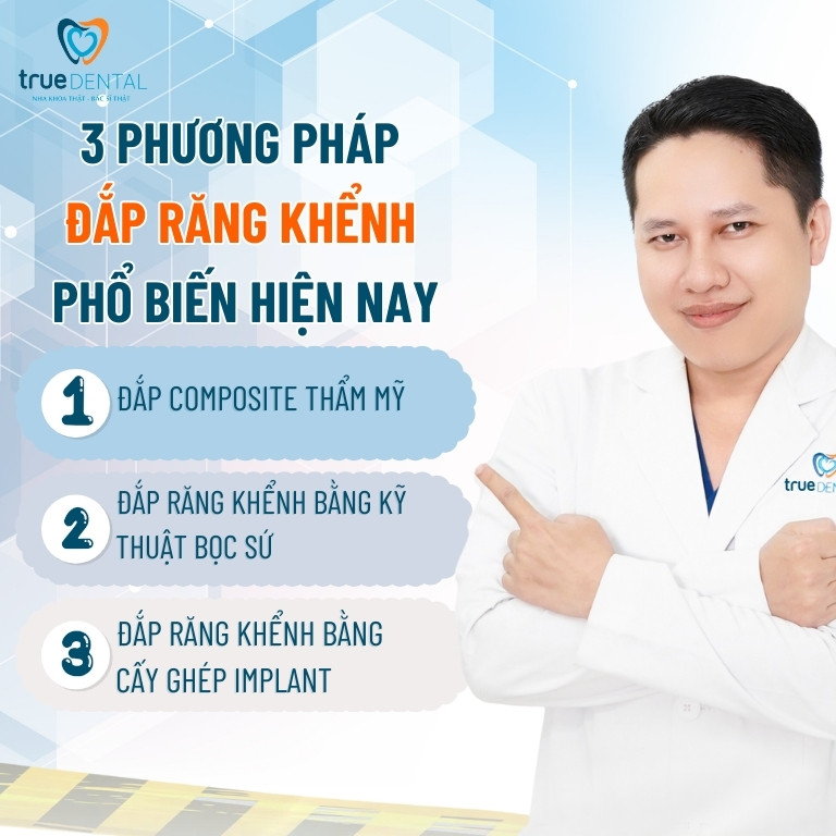 Đắp răng khểnh giữ được bao lâu? Ưu, nhược điểm 2 Các phương pháp đắp răng khểnh phổ biến hiện nay