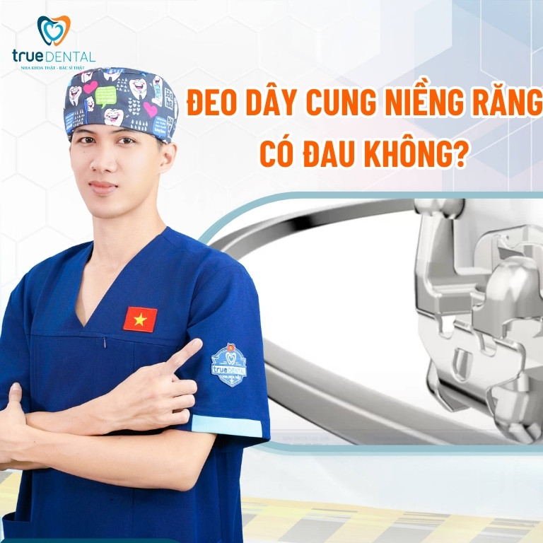 Dây cung niềng răng có tác dụng gì? Có bao nhiêu loại? 11 Đeo dây cung niềng răng có đau không?