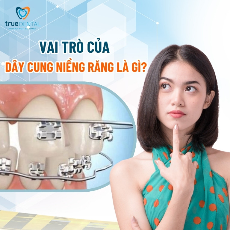 Dây cung niềng răng có tác dụng gì? Có bao nhiêu loại? 3 Vai trò của dây cung niềng răng