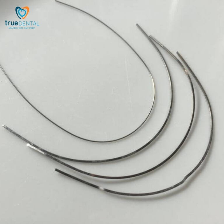 Dây cung niềng răng có tác dụng gì? Có bao nhiêu loại? 5 Dây cung Stainless Steel (làm từ thép không gỉ)