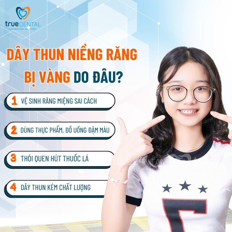 Nguyên nhân làm dây thun niềng răng bị vàng và cách xử lý 3 Dây thun niềng răng bị vàng do đâu?