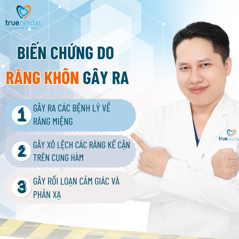 Không nhổ răng khôn có sao không? Trường hợp nào bắt buộc nhổ 5 Biến chứng do răng khôn gây ra