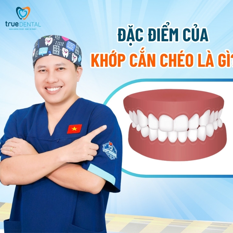 Khớp cắn chéo: Đặc điểm và cách chữa trị 2 Đặc điểm của khớp cắn chéo