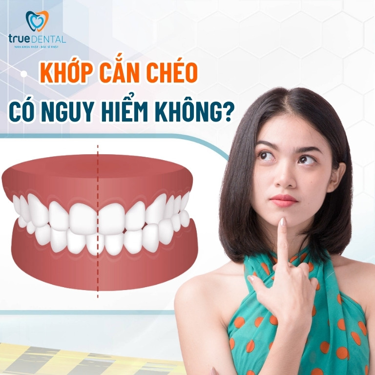 Khớp cắn chéo: Đặc điểm và cách chữa trị 4 Khớp cắn chéo có nguy hiểm không?