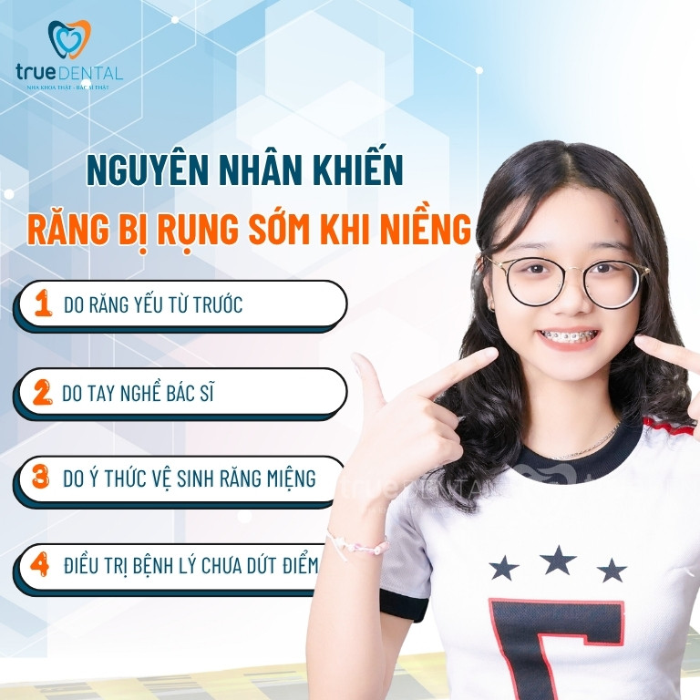 Niềng răng có bị rụng răng sớm không? 3 Nguyên Nhân Khiến Răng Bị Rụng Sớm Khi Niềng