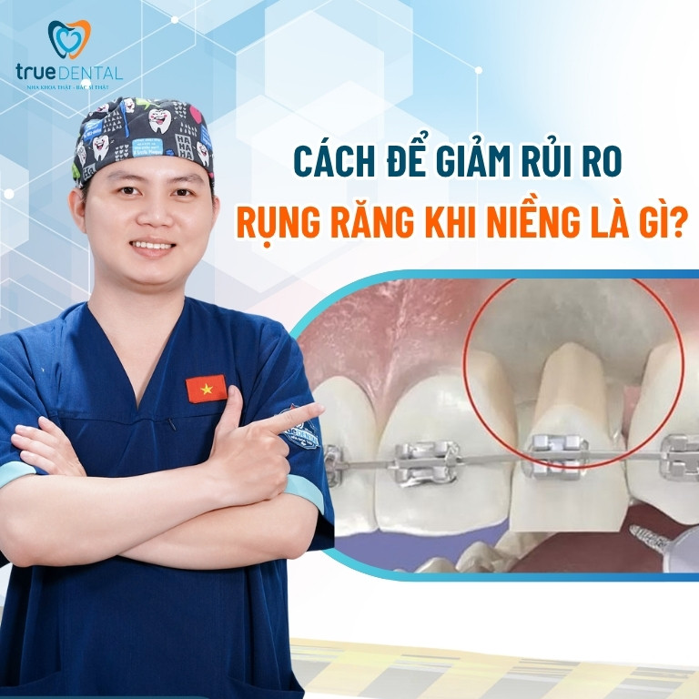 Niềng răng có bị rụng răng sớm không? 4 Cách để giảm rủi ro bị rụng răng sớm khi niềng răng