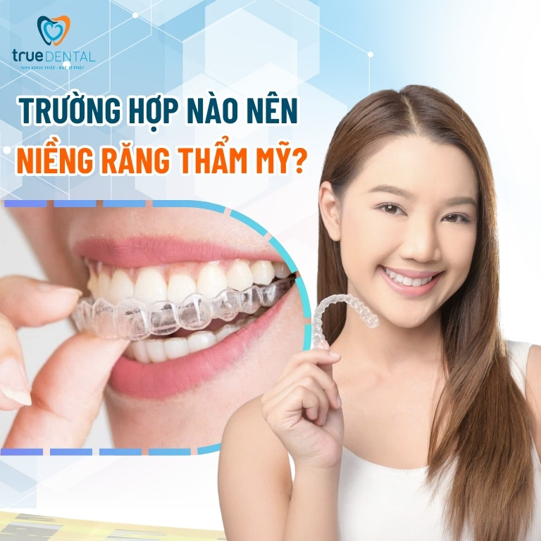 Niềng răng thẩm mỹ là gì? Giá bao nhiêu? 2 7 trường hợp nên niềng răng thẩm mỹ
