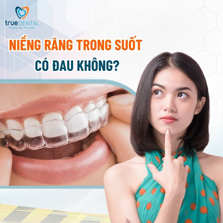 Niềng răng trong suốt có đau không? Giai đoạn nào đau nhất? 2 Niềng răng trong suốt có đau không?