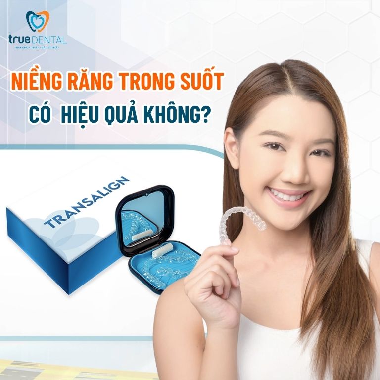 Niềng răng trong suốt giá bao nhiêu? Cập nhật bảng giá 2025 6 Niềng răng trong suốt có tốt và hiệu quả không?