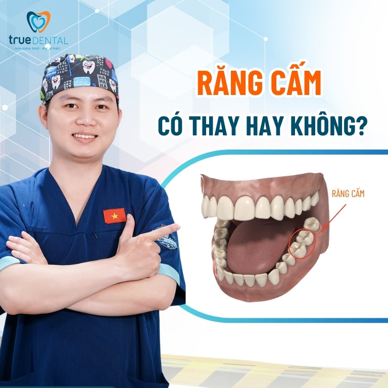 Răng cấm là răng số mấy? Có thay không? 3 Răng cấm có thay hay không?