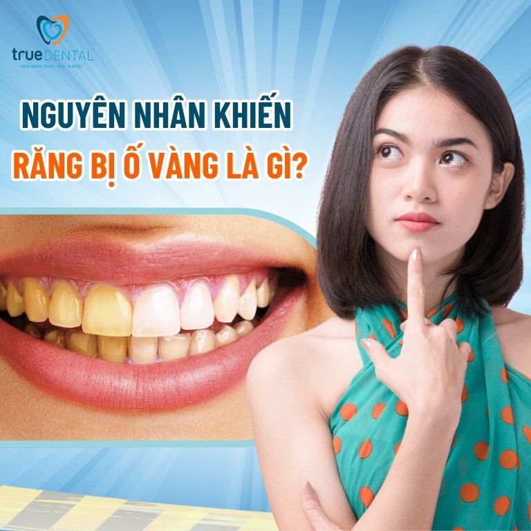 Răng ố vàng: Nguyên nhân và cách khắc phục hiệu quả 2 Nguyên nhân khiến răng bị ố vàng