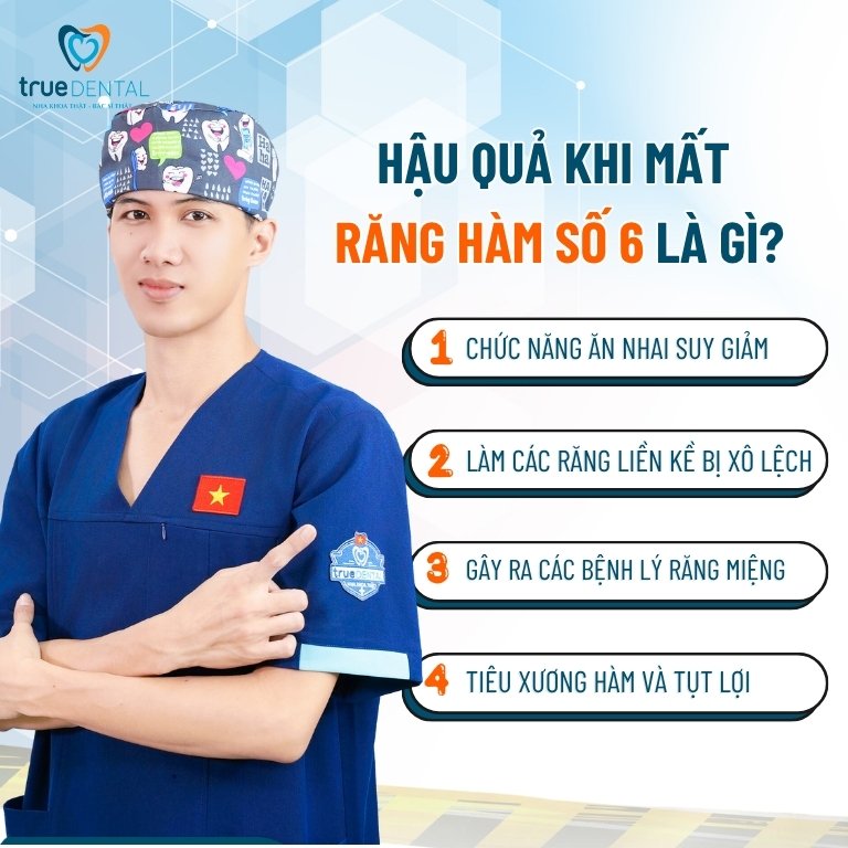 Răng số 6 là răng nào? Vai trò và những điều cần biết 6 Hậu quả khi mất răng hàm số 6 là gì?