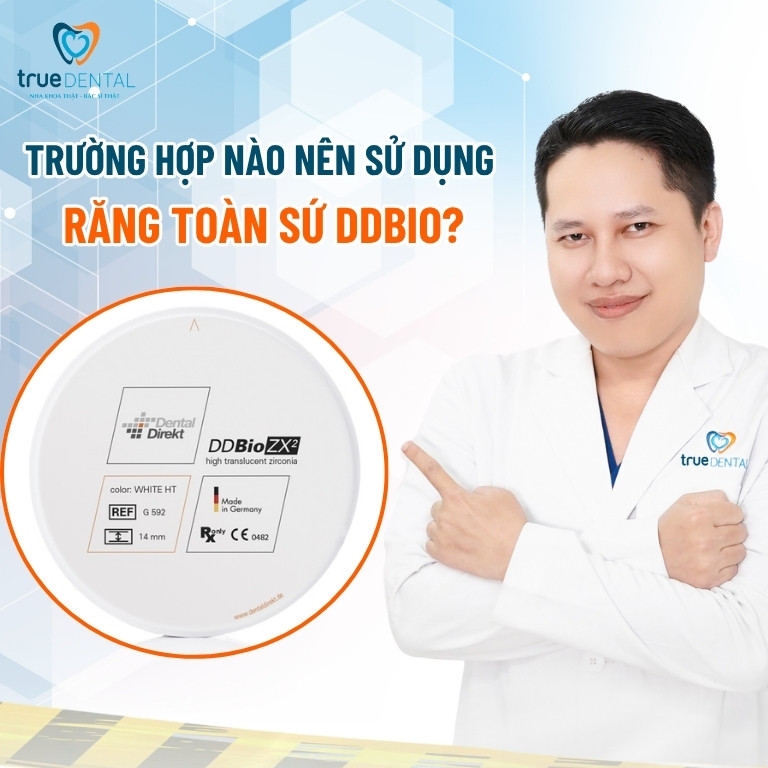 Răng sứ DDBio của nước nào? Có tốt không? 3 Trường hợp nào nên sử dụng răng toàn sứ Ddbio?