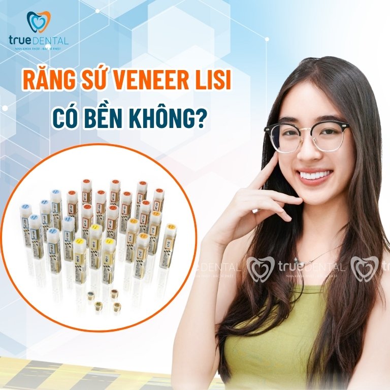 Răng sứ Lisi là gì? Có tốt không? Giá bao nhiêu? 4 Răng sứ Veneer Lisi có bền không?