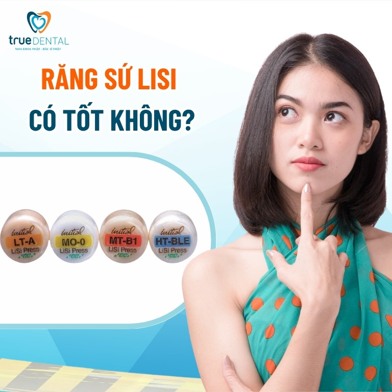Răng sứ Lisi là gì? Có tốt không? Giá bao nhiêu? 2 Răng sứ Lisi có tốt không?
