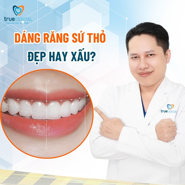 Răng thỏ là gì? Có nên làm răng sứ thỏ không? 4 Dáng răng sứ thỏ đẹp hay xấu?