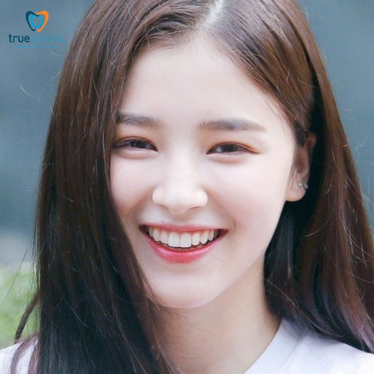 Răng thỏ là gì? Có nên làm răng sứ thỏ không? 2 Răng thỏ có ý nghĩa gì?