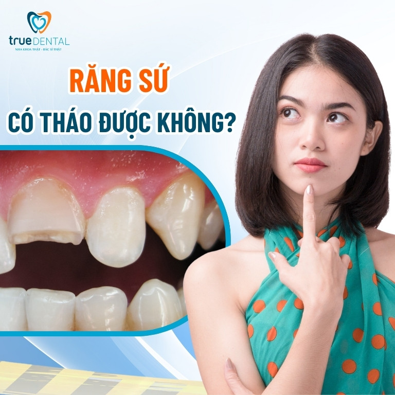 Tháo răng sứ có đau không? Trường hợp nào nên tháo? 1 Răng sứ có tháo được không?
