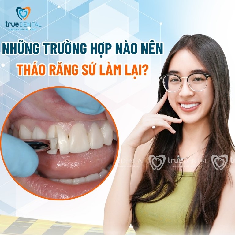 Tháo răng sứ có đau không? Trường hợp nào nên tháo? 2 Tháo răng sứ làm lại trong những trường hợp nào?